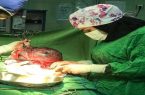 خارج کردن توده ۵ کیلویی از شکم مادر باردار